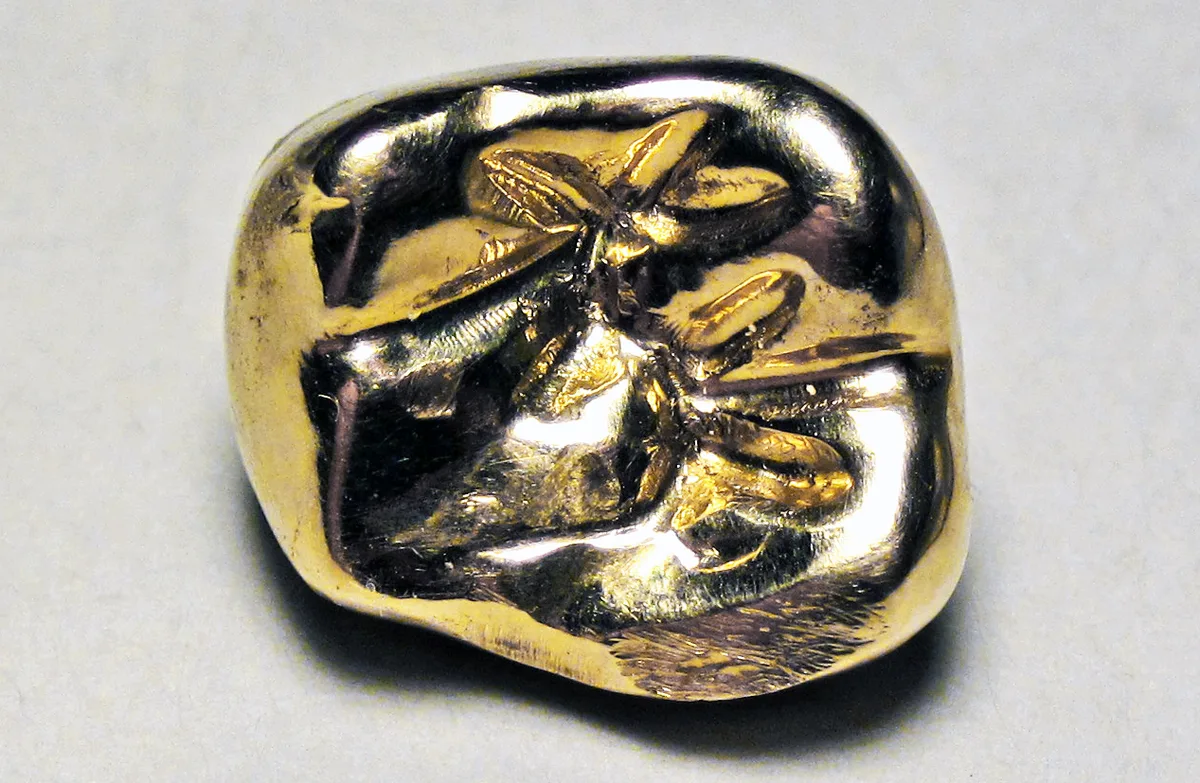Gold dental crown, the kind of dental gold Apex Gold Silver Coin in Winston-Salem buys for its gold content